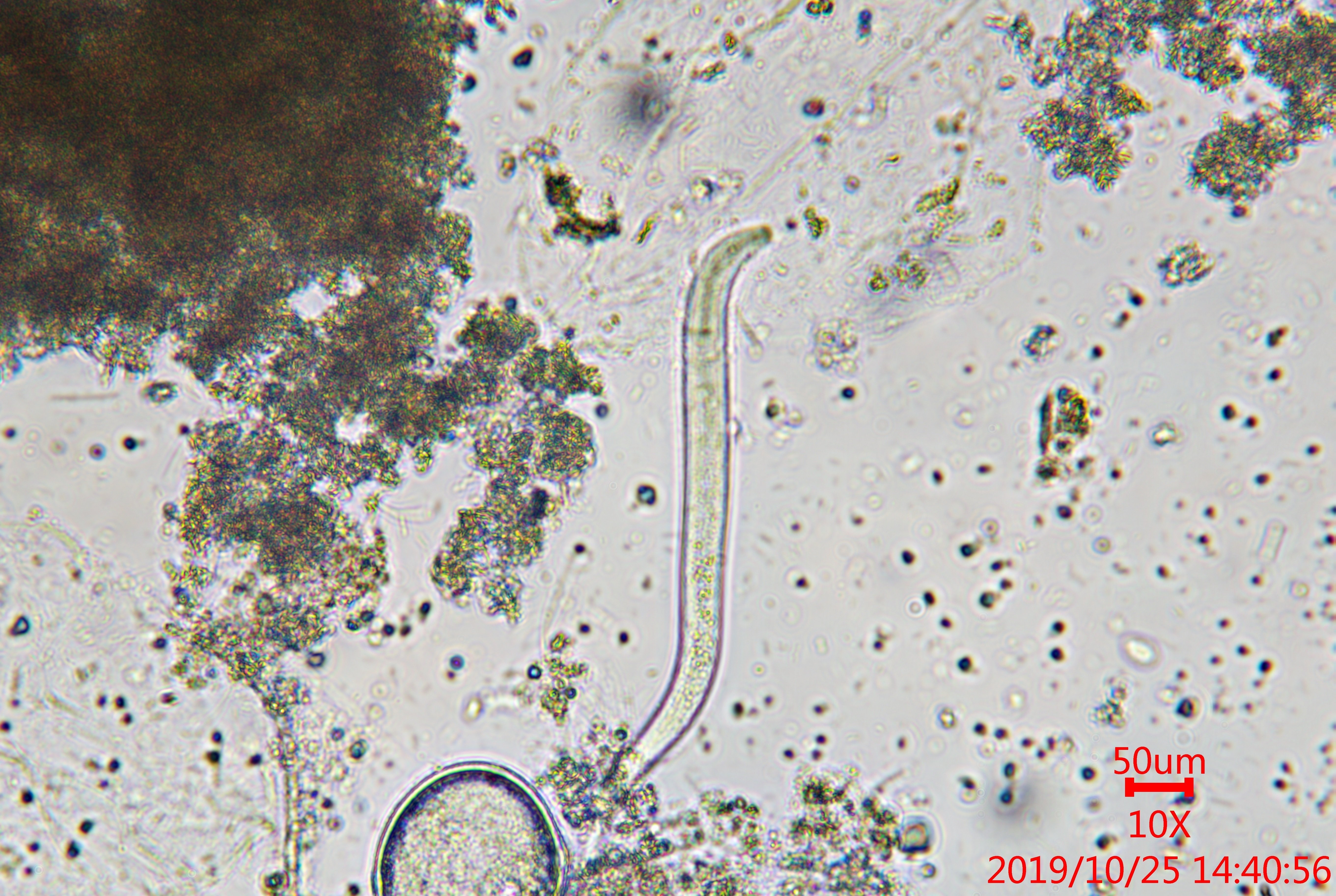 水中浮游生物观察样2